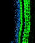 干细胞科学家探索内耳的潜在再生潜力